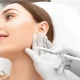 Jawline Fillers in Dubai