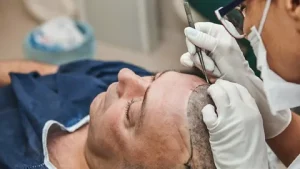 Hair Transplant