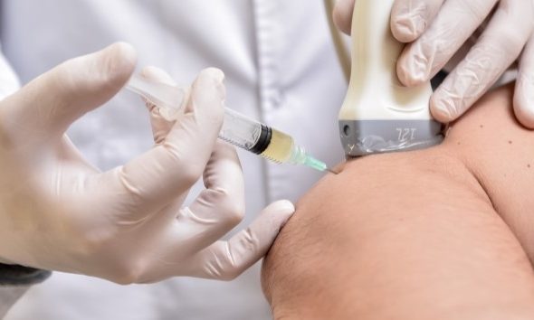 Prp treatment Michigan