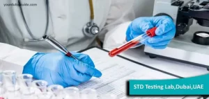 STD Test