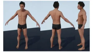 Gynaecomastia Surgery