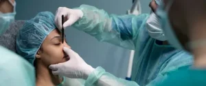 Rhinoplasty