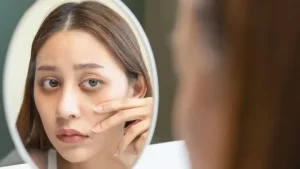 Dark Circles Treatment
