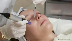 Salmon DNA Injection in Dubai