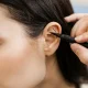 ear reshaping surgery