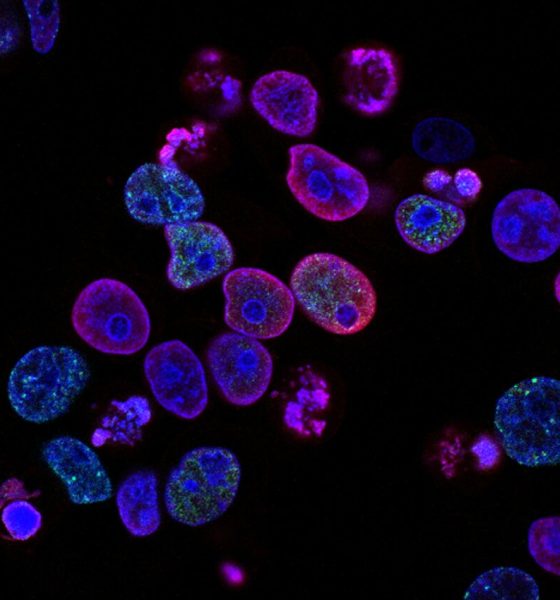 Formulation Development