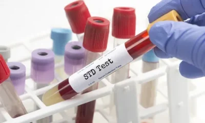 STD Test in Dubai
