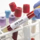 STD Test in Dubai