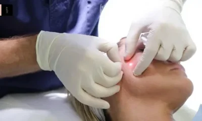 Fat Melting Injection