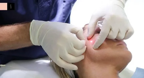 Fat Melting Injection