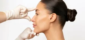 natural rhinoplasty