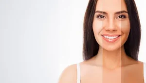 Skin Whitening