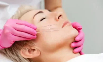 Thread Lift