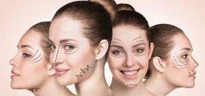 Reconstructive Jaw Surgery