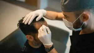Beard Hair Transplant
