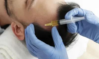 PRP Therapy