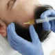 PRP Therapy