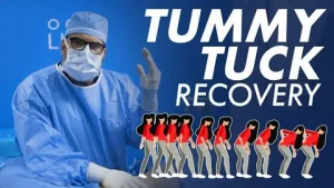 Tummy Tuck