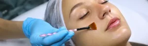 Chemical peels