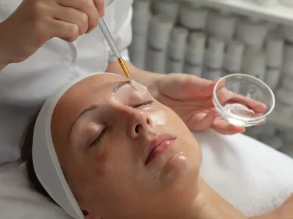 Chemical peels