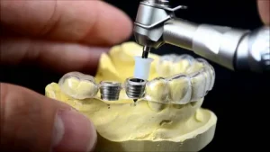 Dental Implant Drill
