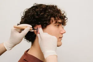 Otoplasty in Islamabad