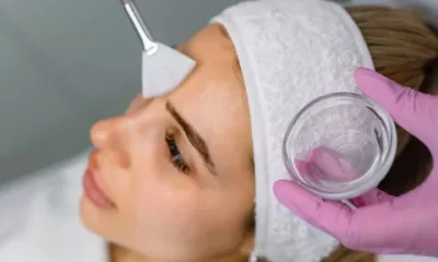 Chemical Peel