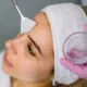 Chemical Peel