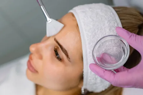 Chemical Peel