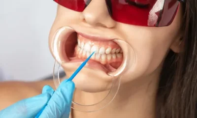 Teeth Whitening