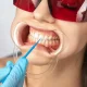 Teeth Whitening