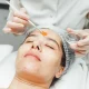 Chemical Peel