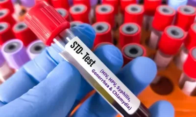 STD Test in Dubai