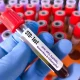 STD Test in Dubai