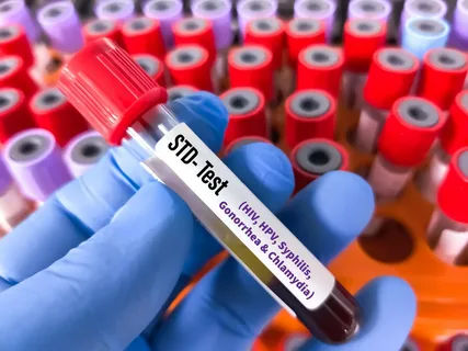 STD Test in Dubai