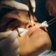 Ultrasonic Rhinoplasty