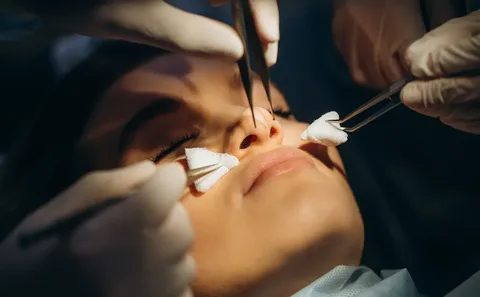 Ultrasonic Rhinoplasty