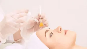Chemical Peel