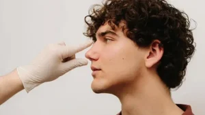 Rhinoplasty for Men