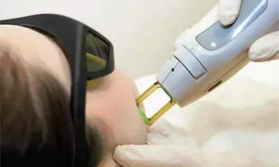 Laser Hair Removal