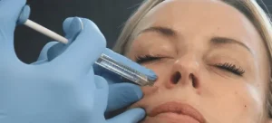Dermal Fillers