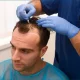 Hair Transplant Abu Dhabi