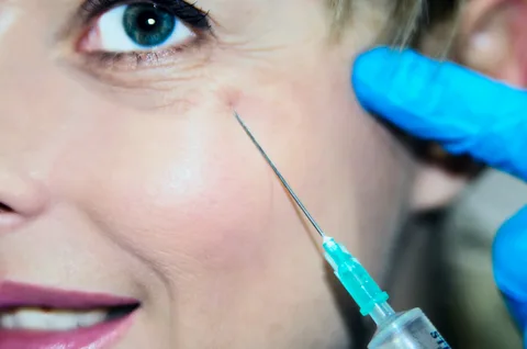 Dysport Injections