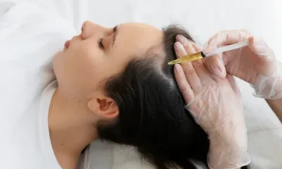 PRP Hair Treatment