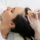 PRP Hair Treatment