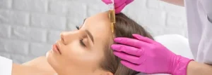 PRP Hair Treatment