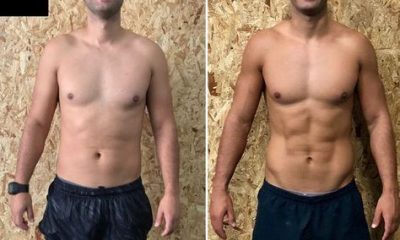 Six Pack Abs Surgery