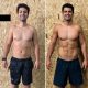 Six Pack Abs Surgery