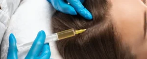 PRP Hair Treatment
