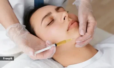 Mesotherapy Treatment